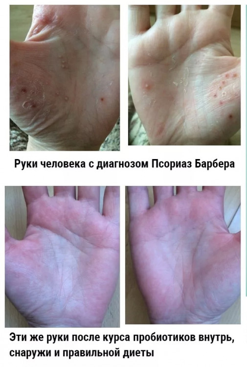 Пробиотический крем RepairSkin